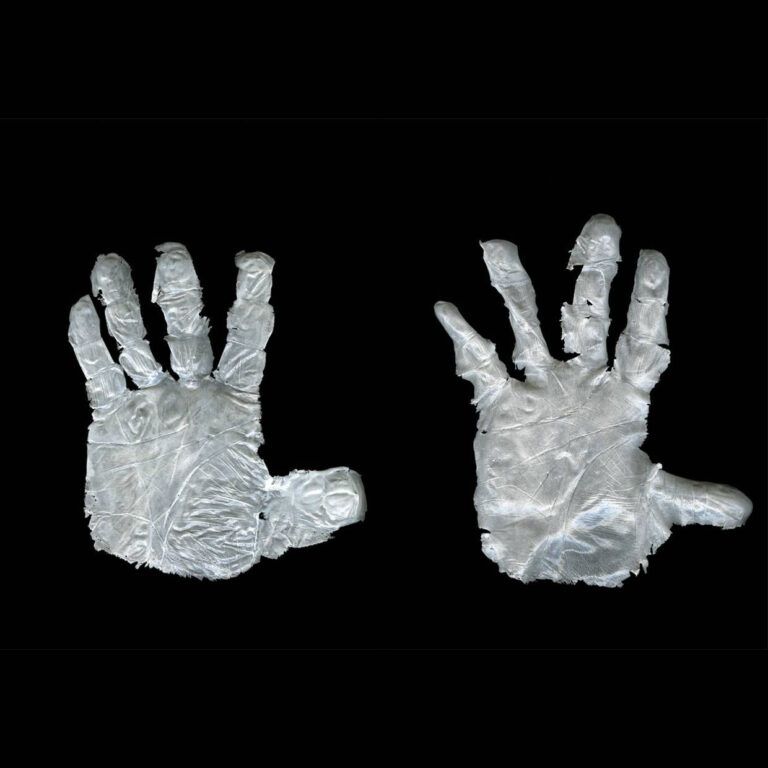 Two images of a white skin that has been peeled from a pair of hands