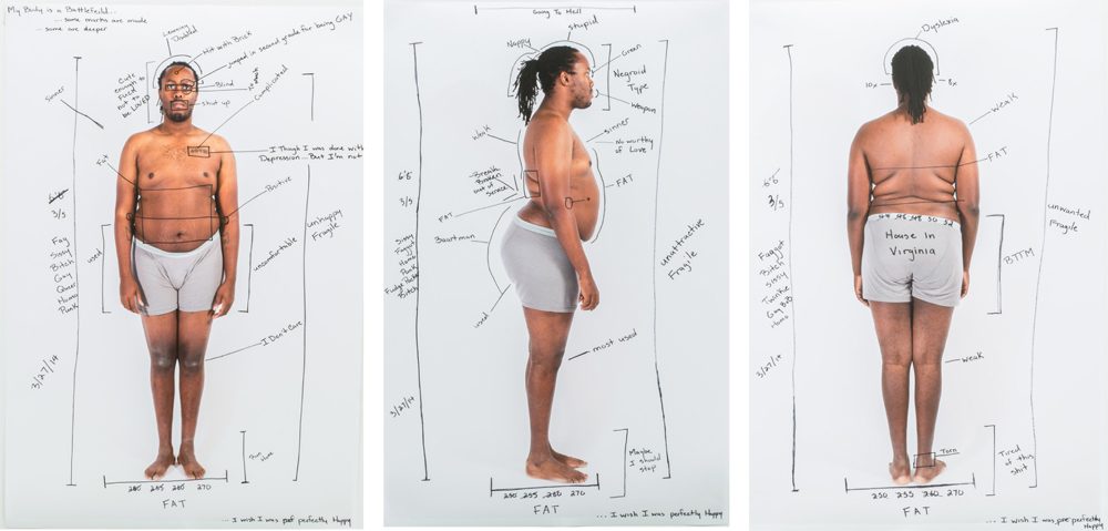 Three images of a man in undergarments photographed from the front, side, and back with annotations made on the images